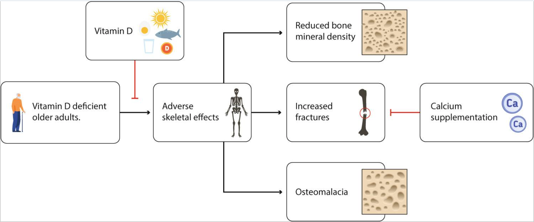 老年人維生素D缺乏對骨骼的影響以及維生素D在預防中的作用