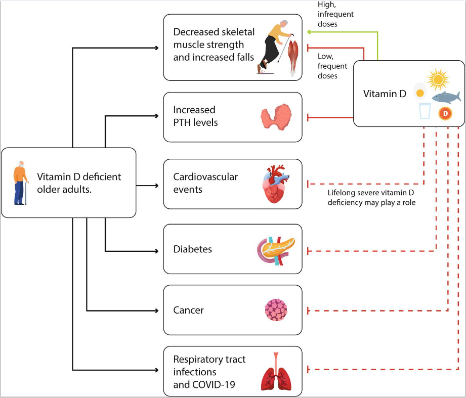 老年人缺乏維生素D對骨骼的額外影響以及維生素D的預防作用